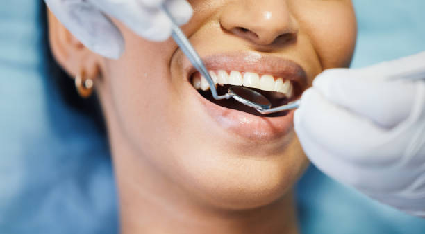 Best Emergency Treatment for Dental Infections or Abscesses in Cypress Gardens, FL