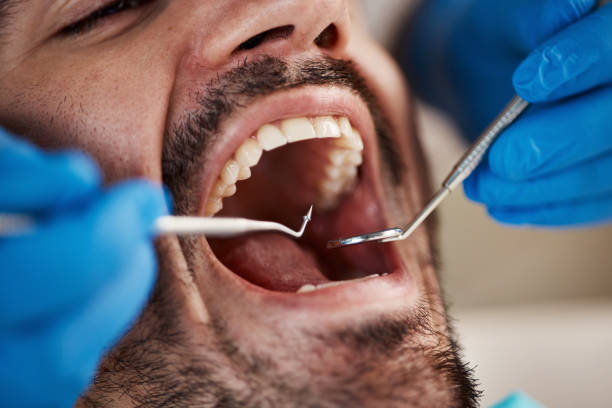Best Emergency TMJ Treatment in Cypress Gardens, FL